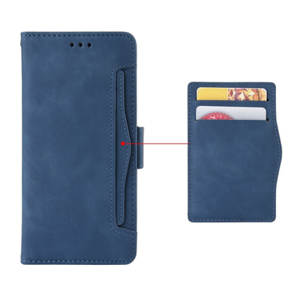 For Doogee S96 Pro Skin Feel Calf Pattern Leather Phone Case(Blue) - Doogee Cases by buy2fix | Online Shopping UK | buy2fix